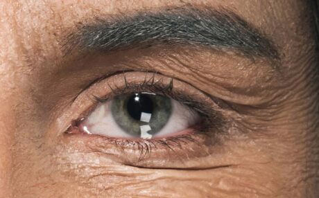 How does oxidative stress affect the body?